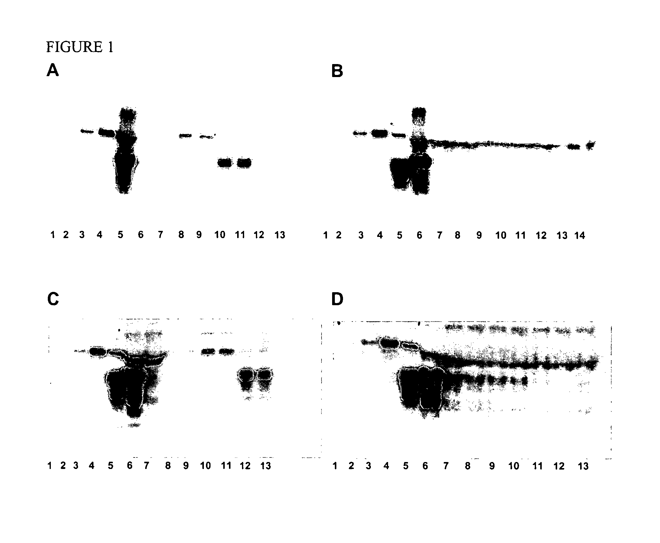 Prion protein binding materials and methods of use