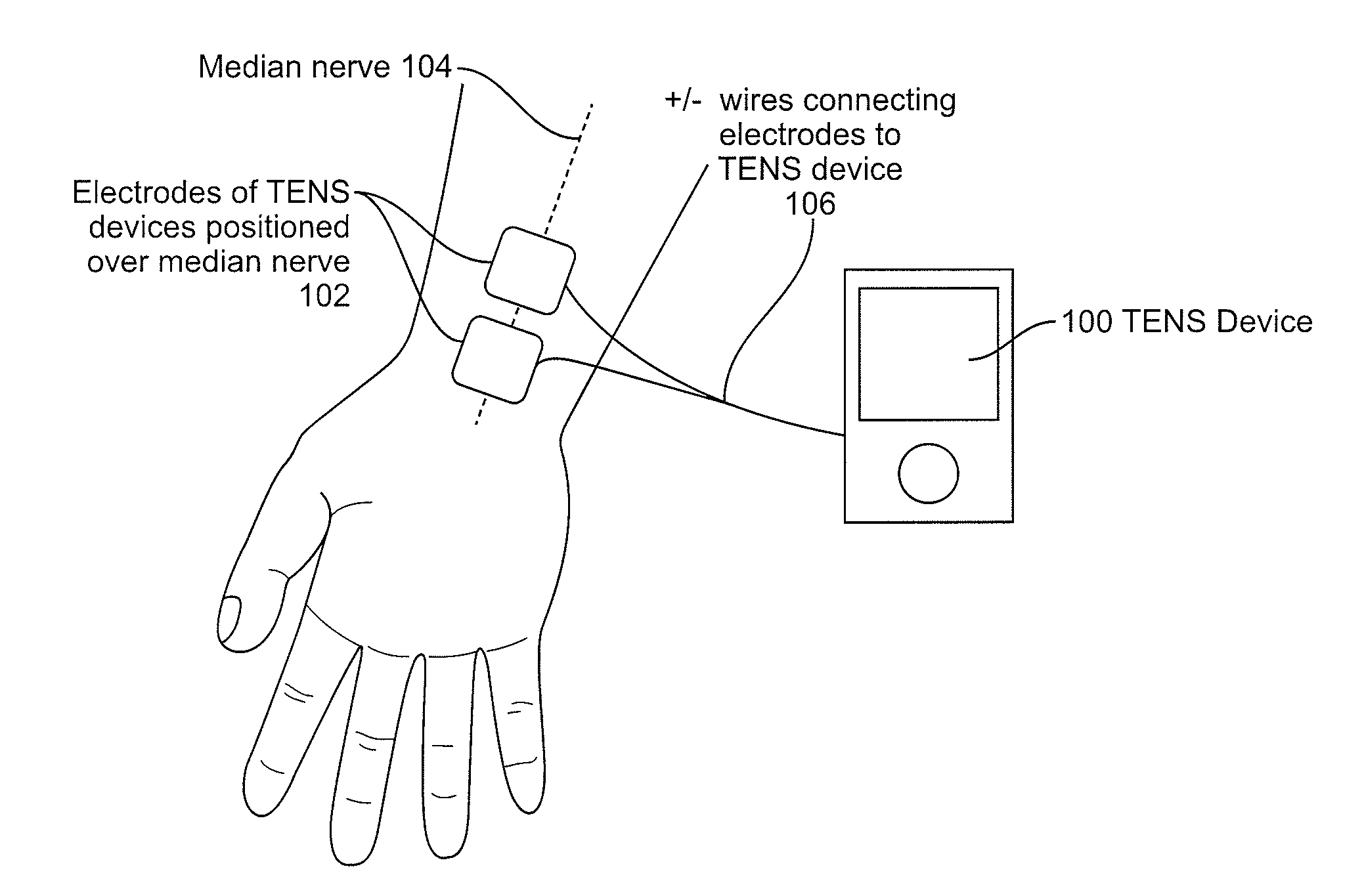 Devices and methods for controlling tremor