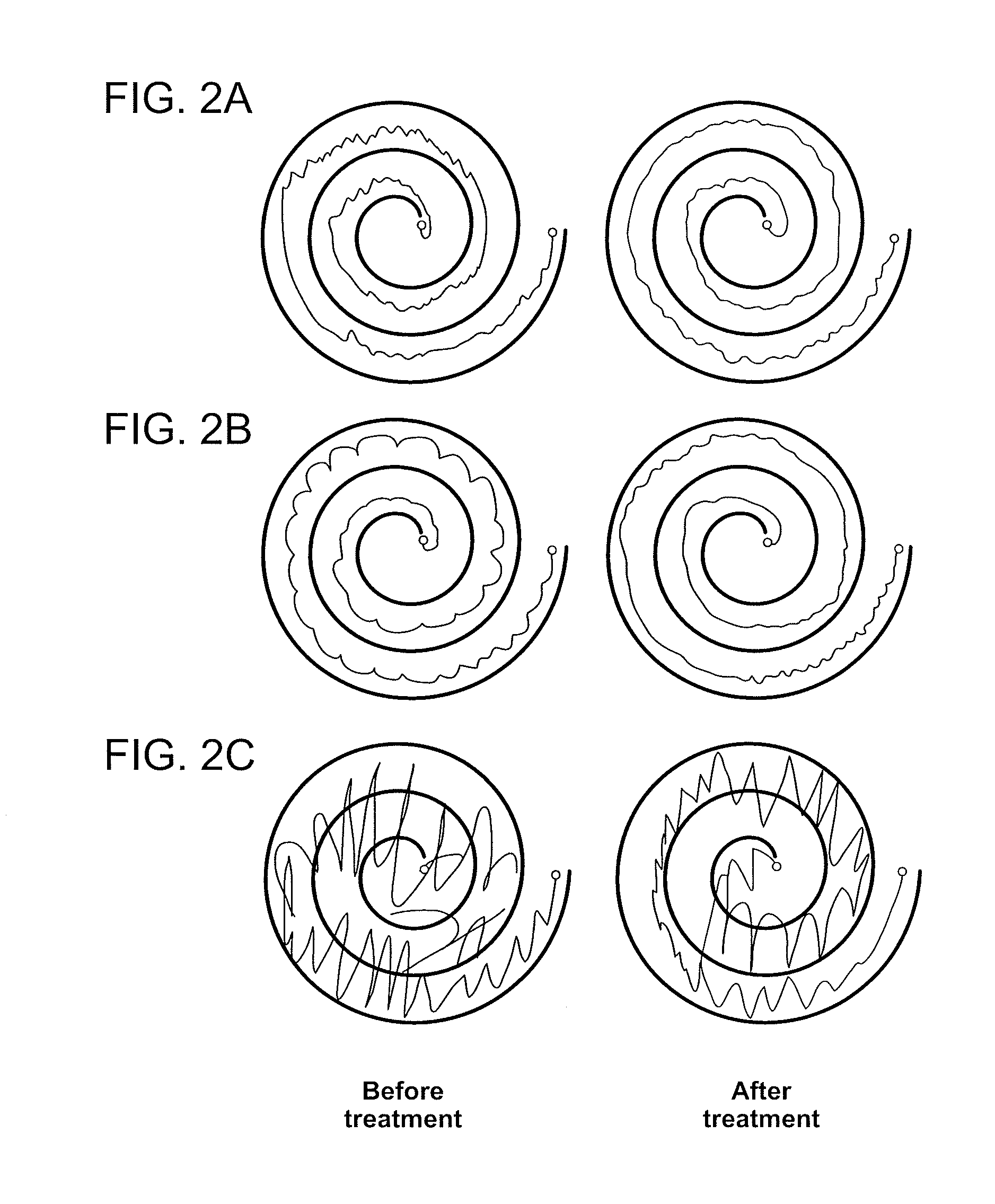 Devices and methods for controlling tremor
