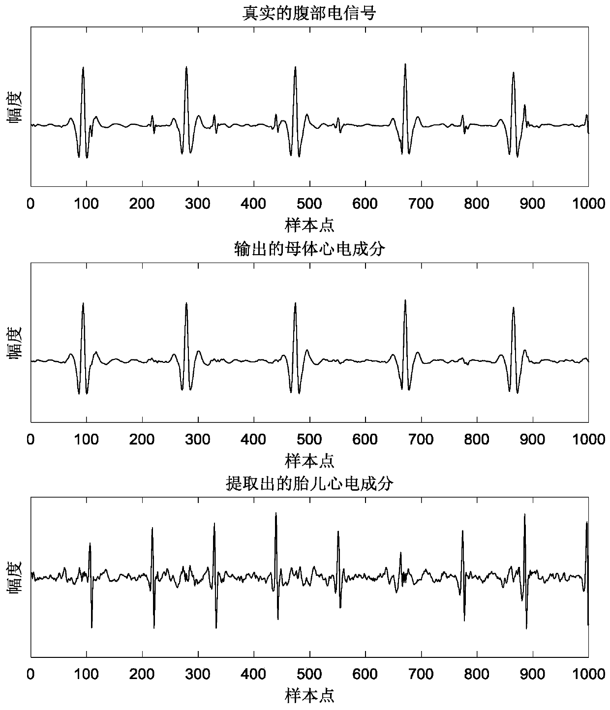 Fetal electrocardiogram extraction system based on convolutional encoding-decoding neural network and method