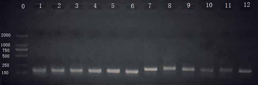 A PCR primer combination, kit and application for the diagnosis of tuberculous ulcer based on rt-qPCR