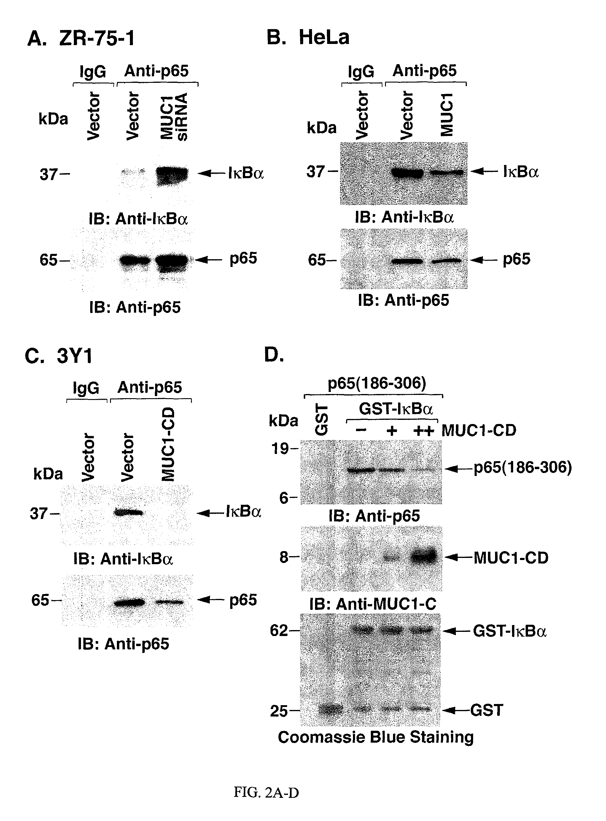 Inhibition of inflammation using antagonists of MUC1