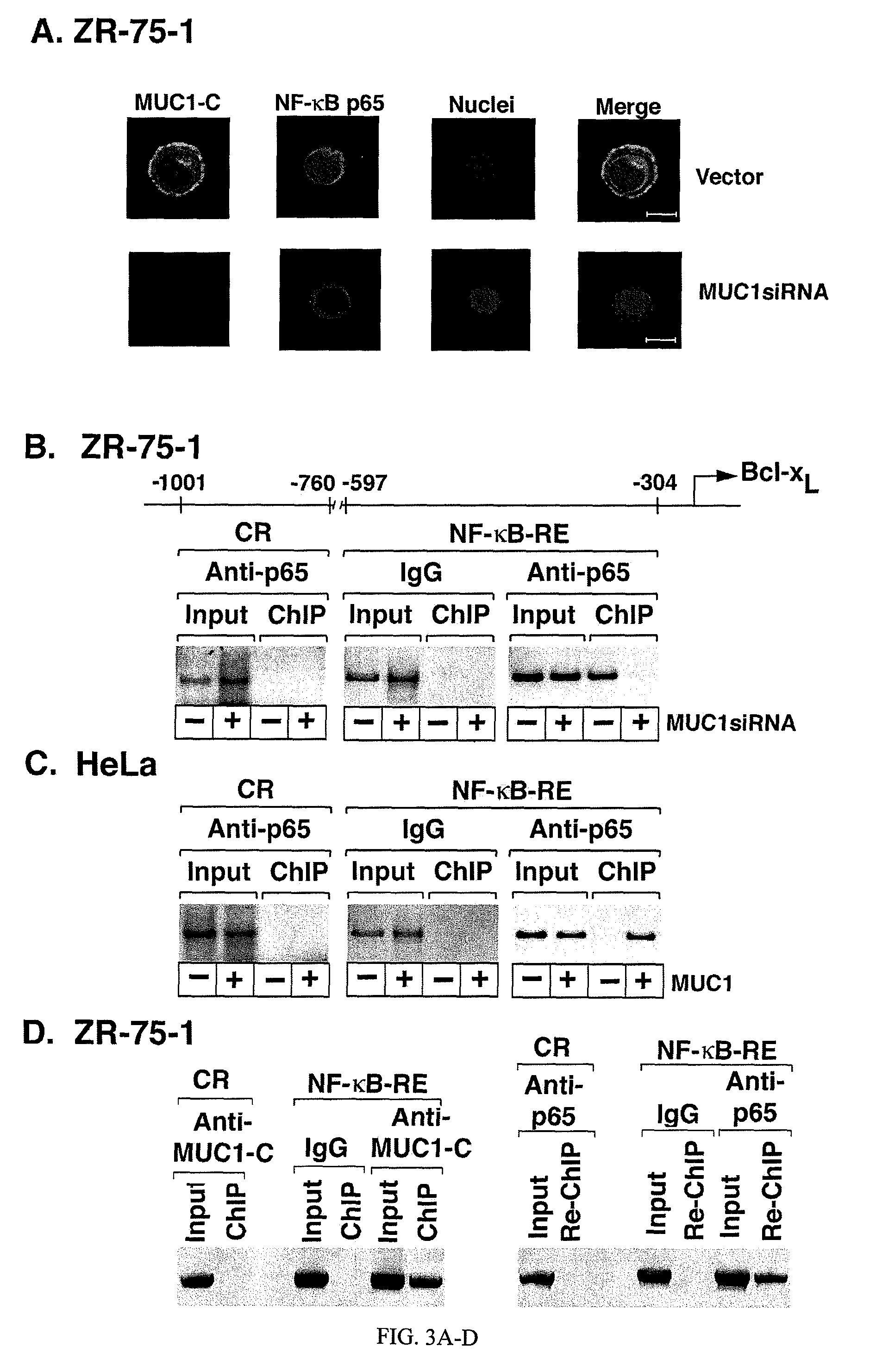 Inhibition of inflammation using antagonists of MUC1