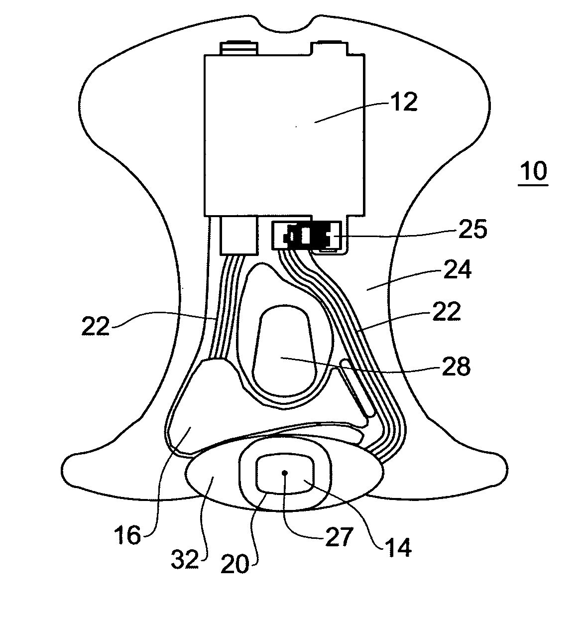 Nail treatment device