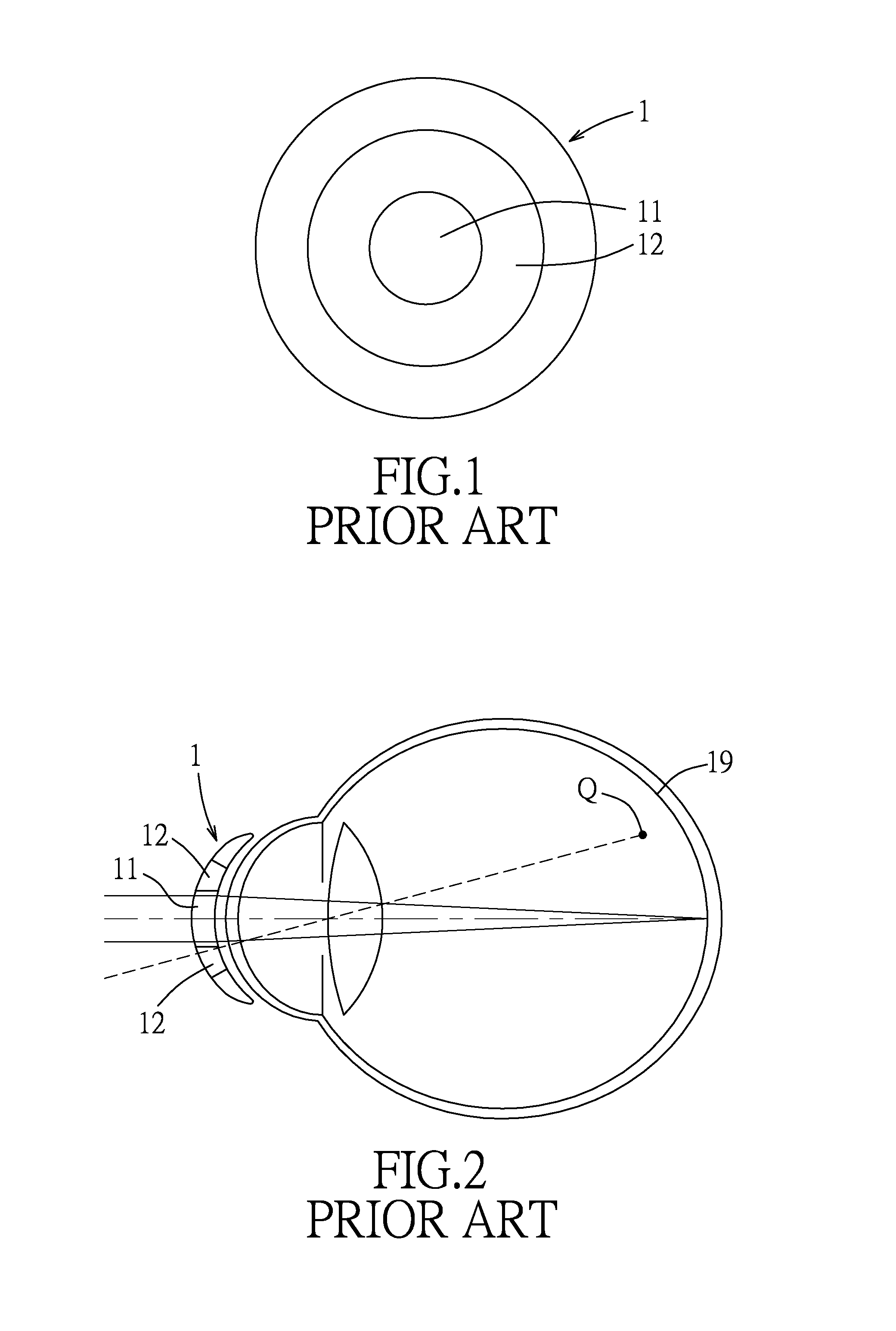 Lens and method for correcting vision of a user