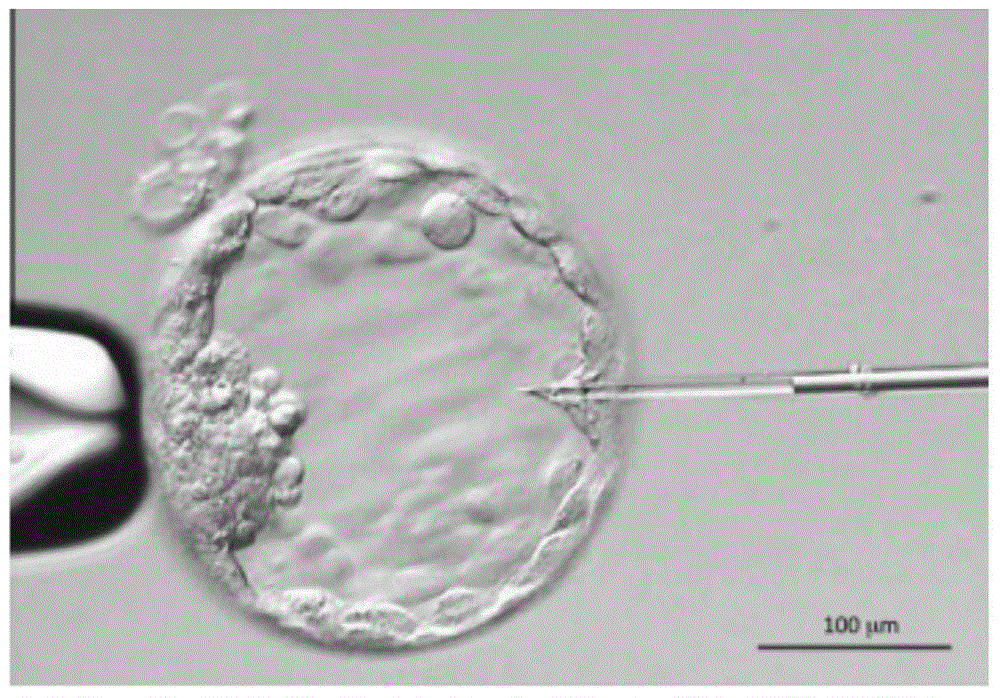 Method for detecting embryonic chromosome abnormality by virtue of blastochyle free DNA