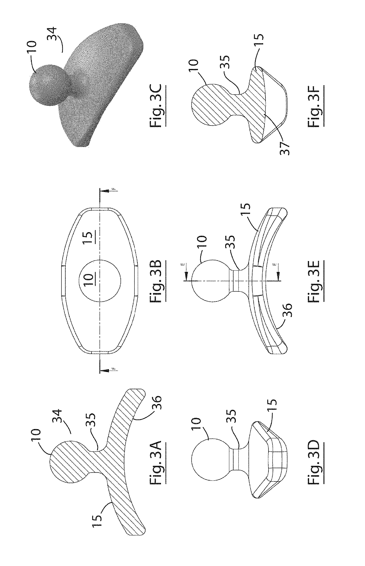 Implant for a bone joint