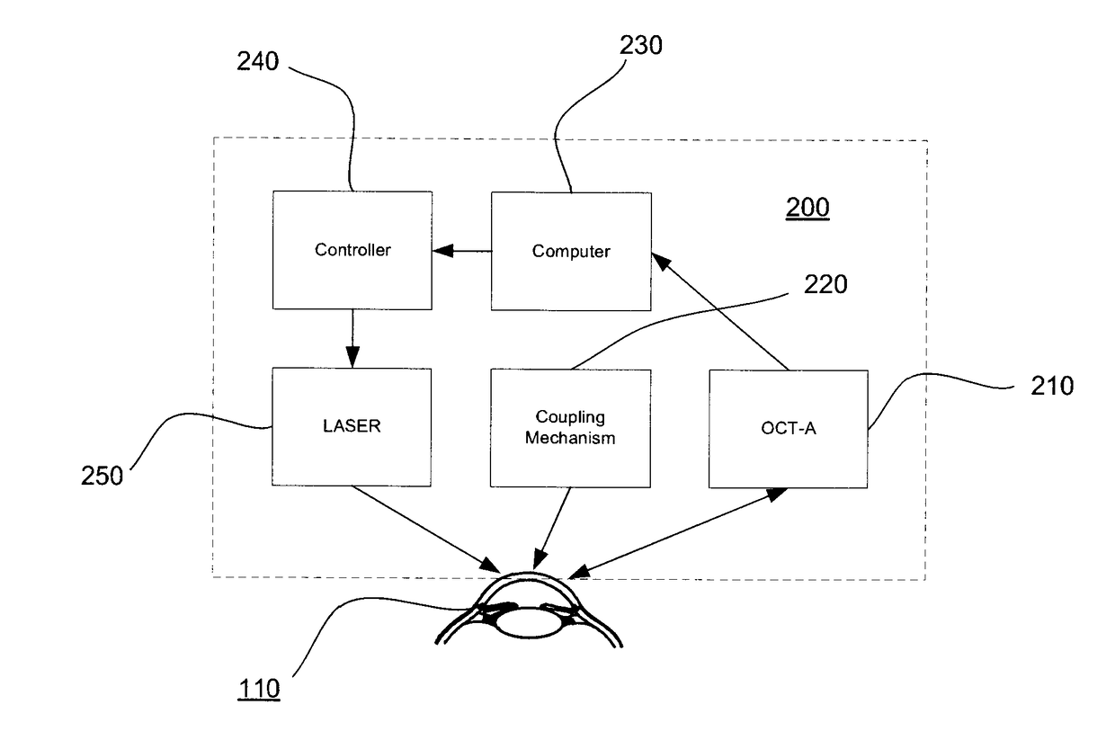 Method And System For Laser Automated Trabecular Excision