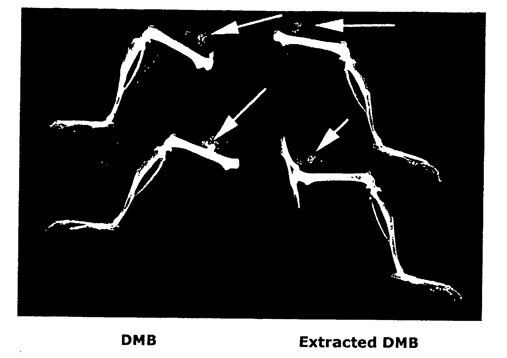 Activating Extraction Of Demineralized Bone Matrix