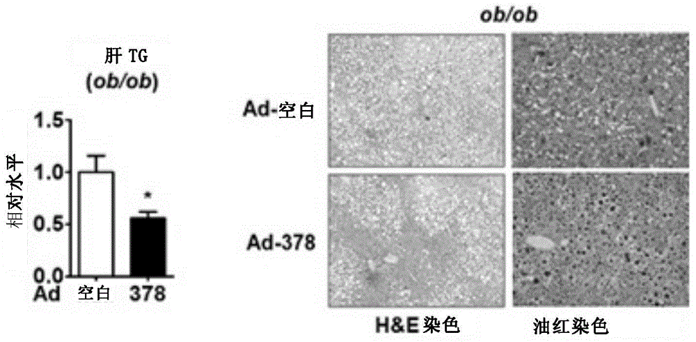 Application of miRNA-378 in treatment of fatty liver