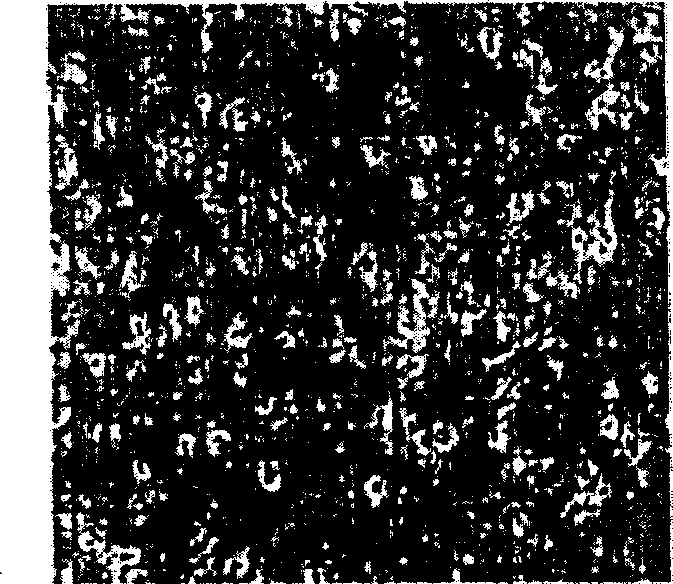 Method of isolating and culturing mesenchymal stem cell derived from umbilical cord blood