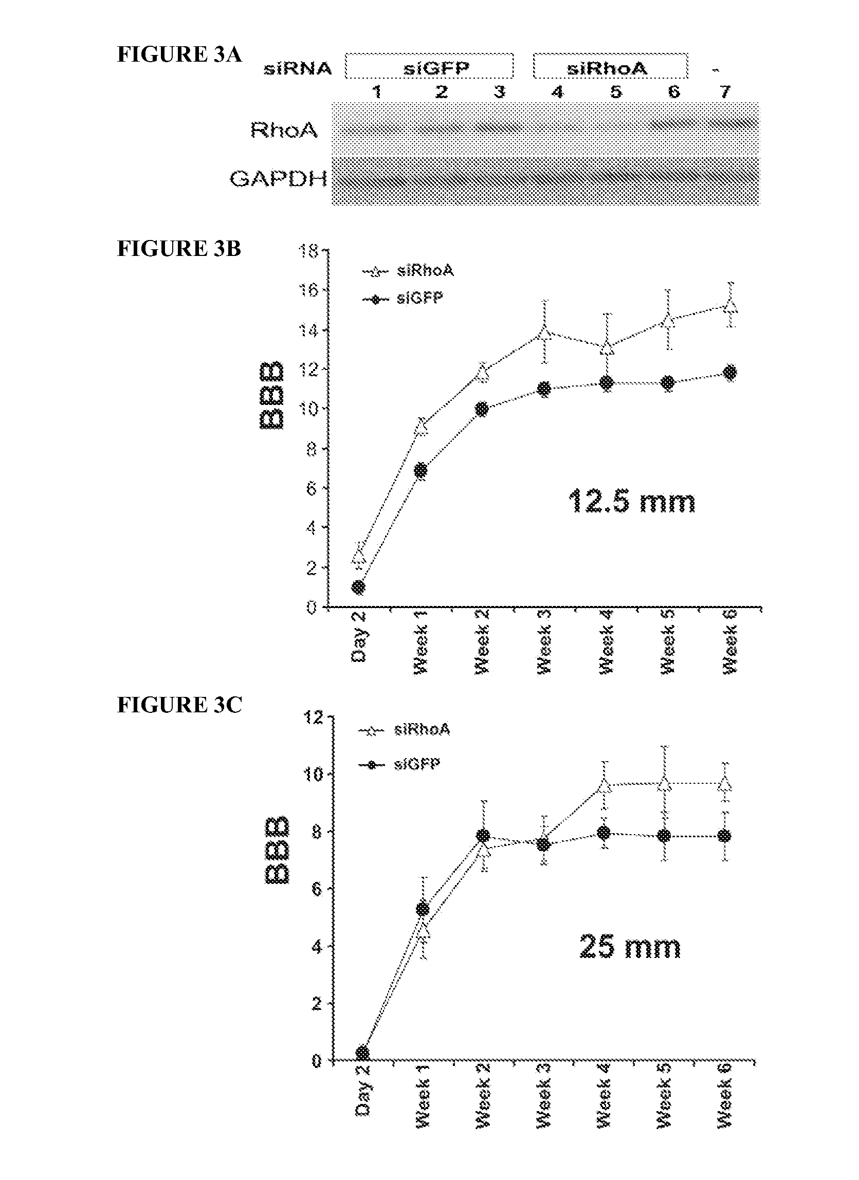Methods for delivery of siRNA to the spinal cord and therapies arising therefrom