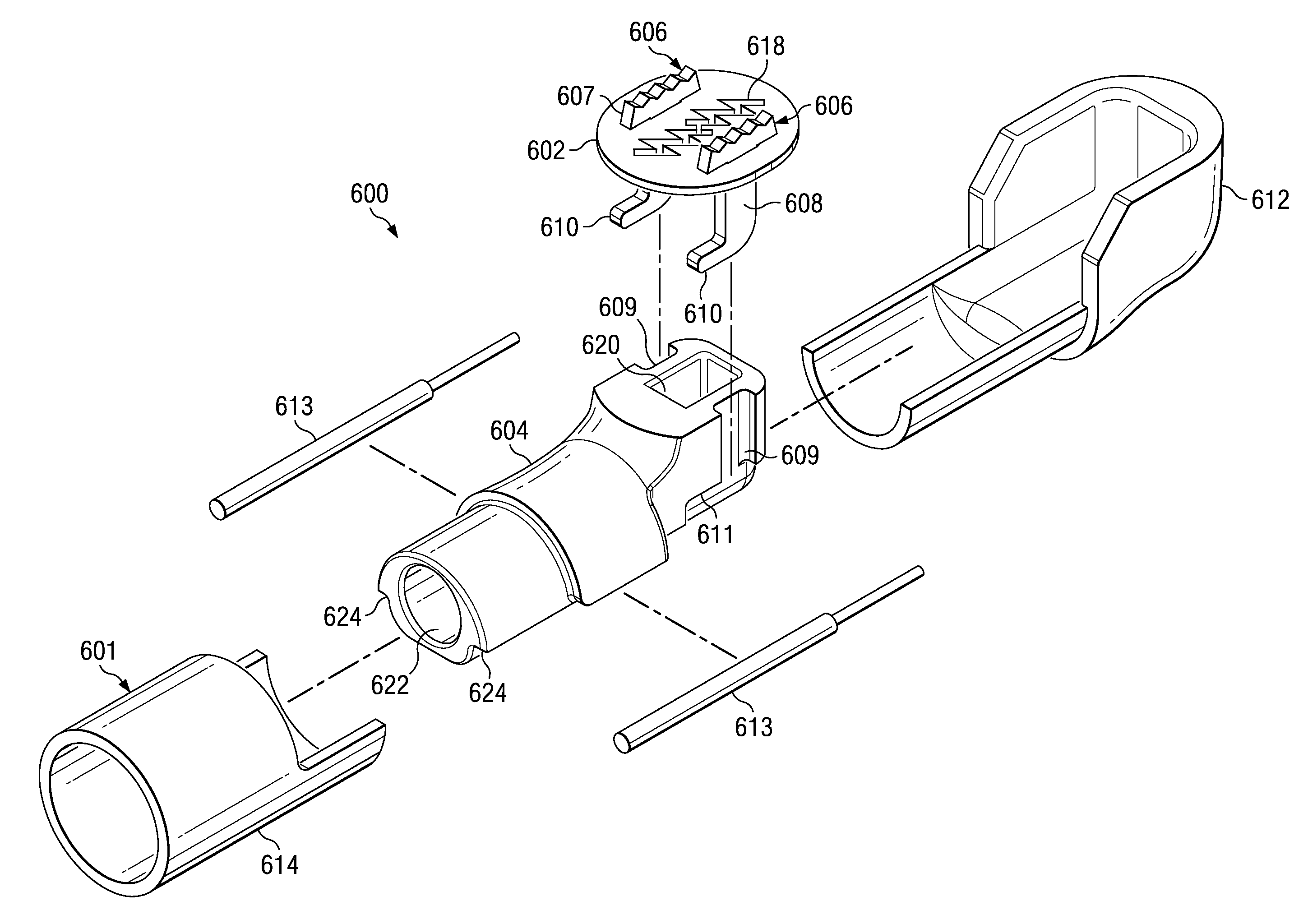 Systems and methods for screen electrode securement