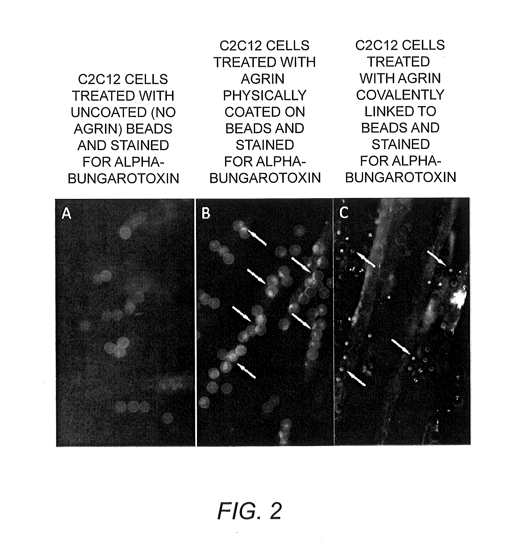 Bioscaffolds for formation of motor endplates and other specialized tissue structures