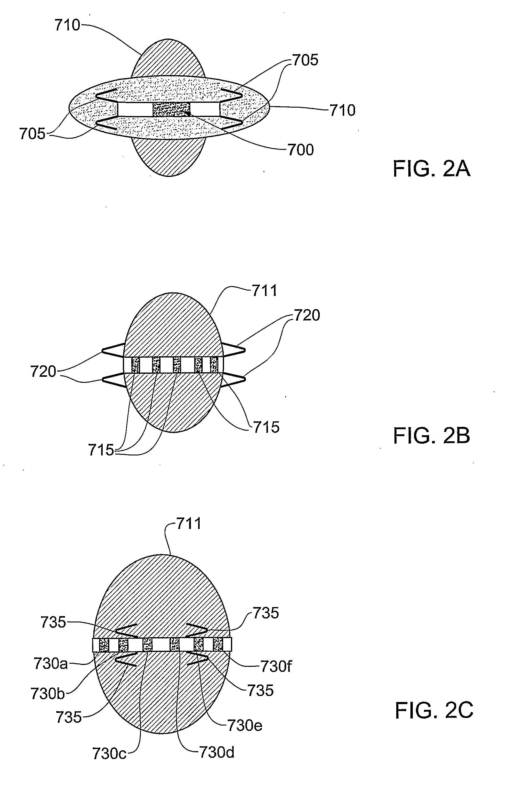 System and method for analysis and treatment of a body tissue