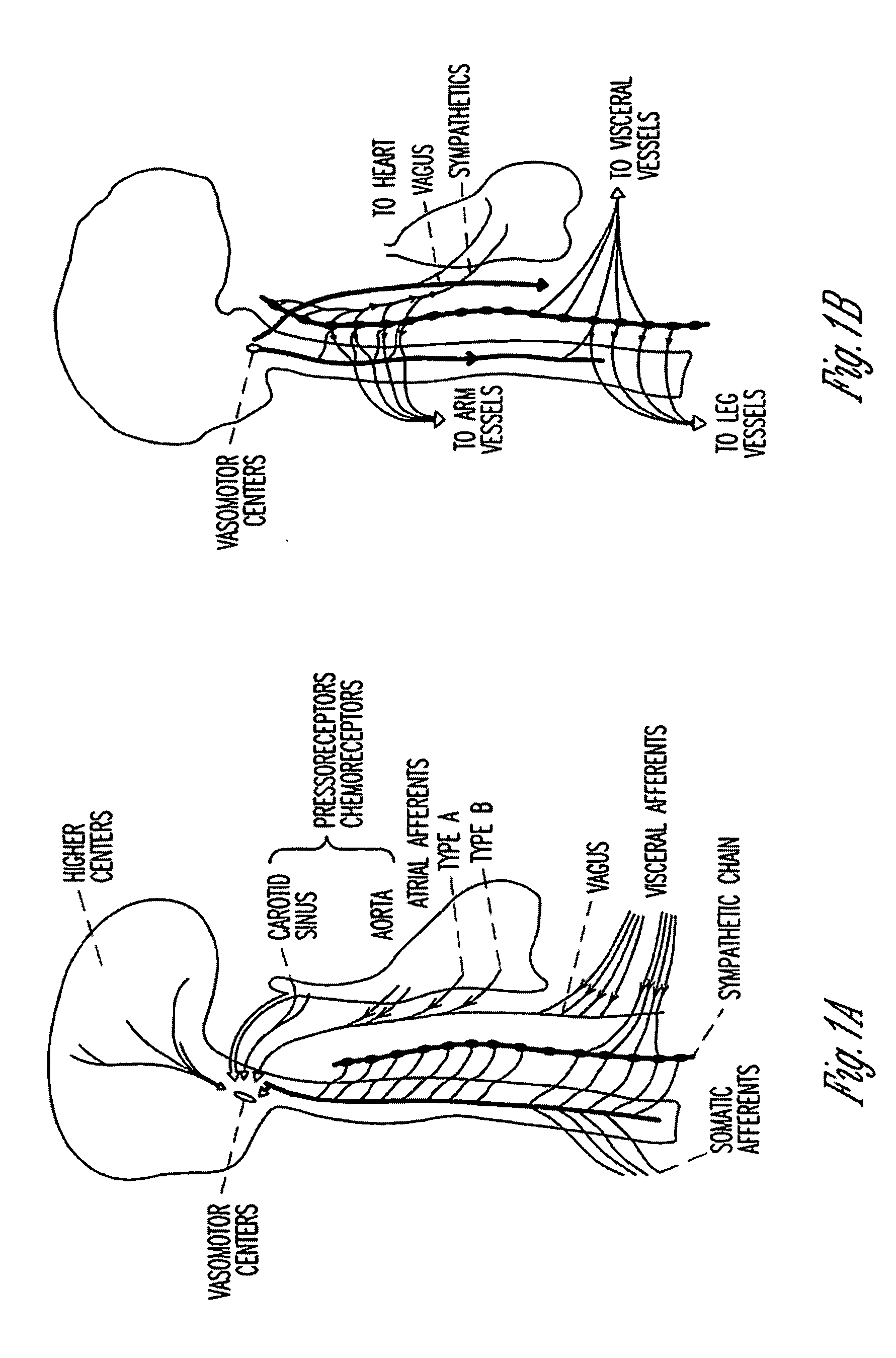 Coordinated therapy for disordered breathing including baroreflex modulation
