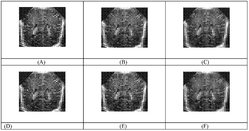 Ultrasonic image noise suppression method