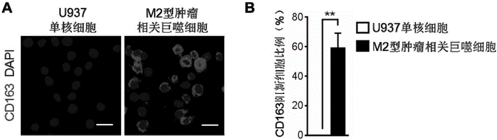 Construction method and application of M2-type tumor-associated macrophage model