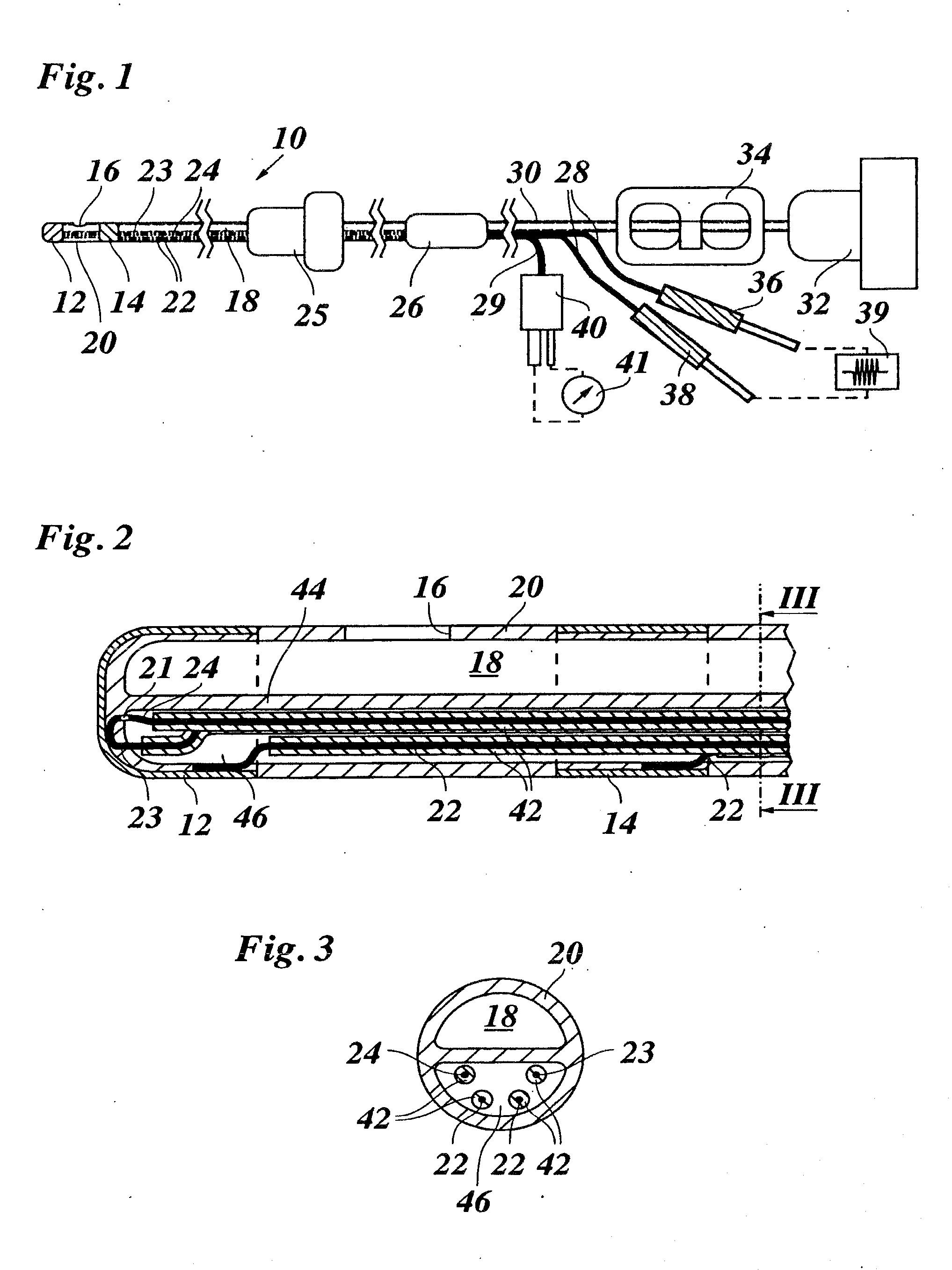 Method for applying pulsed radio frequency energy to the spinal canal