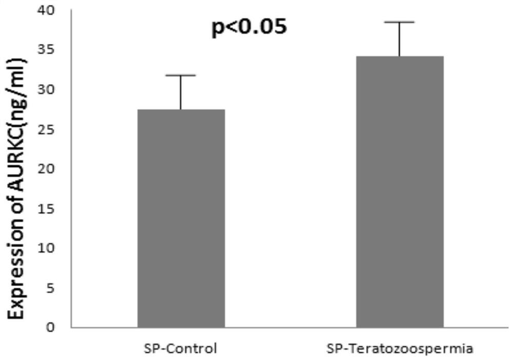Aurkc gene snp locus associated with teratozoospermia and its application