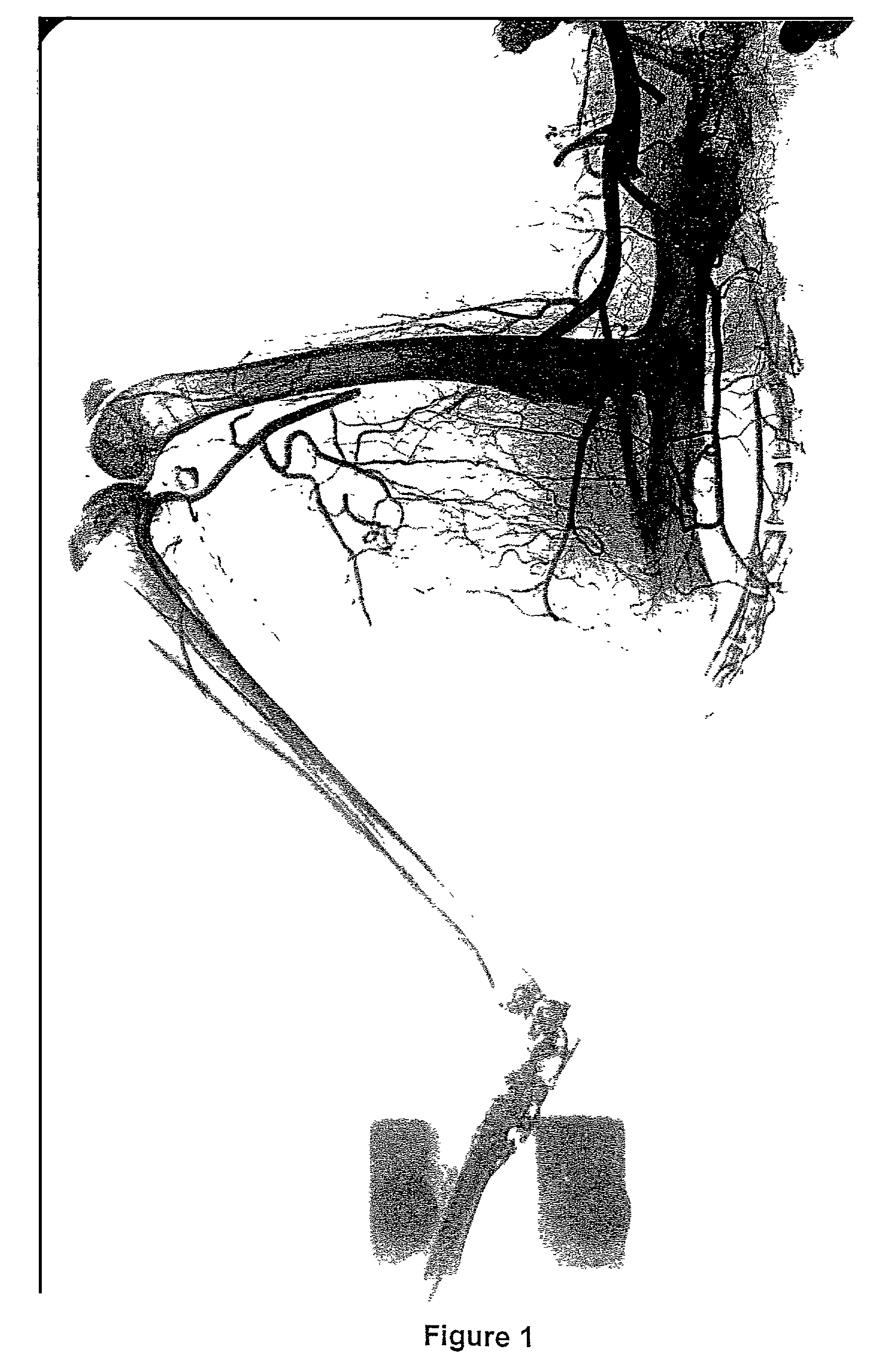 Methods for the modulation of neovascularization and/or the growth of collateral arteries and/or other arteries from preexisting arteriolar connections