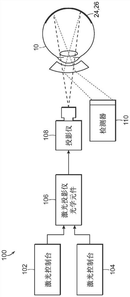 System and process for adjusting treatment parameters for retina phototherapy based on rpe melanin levels