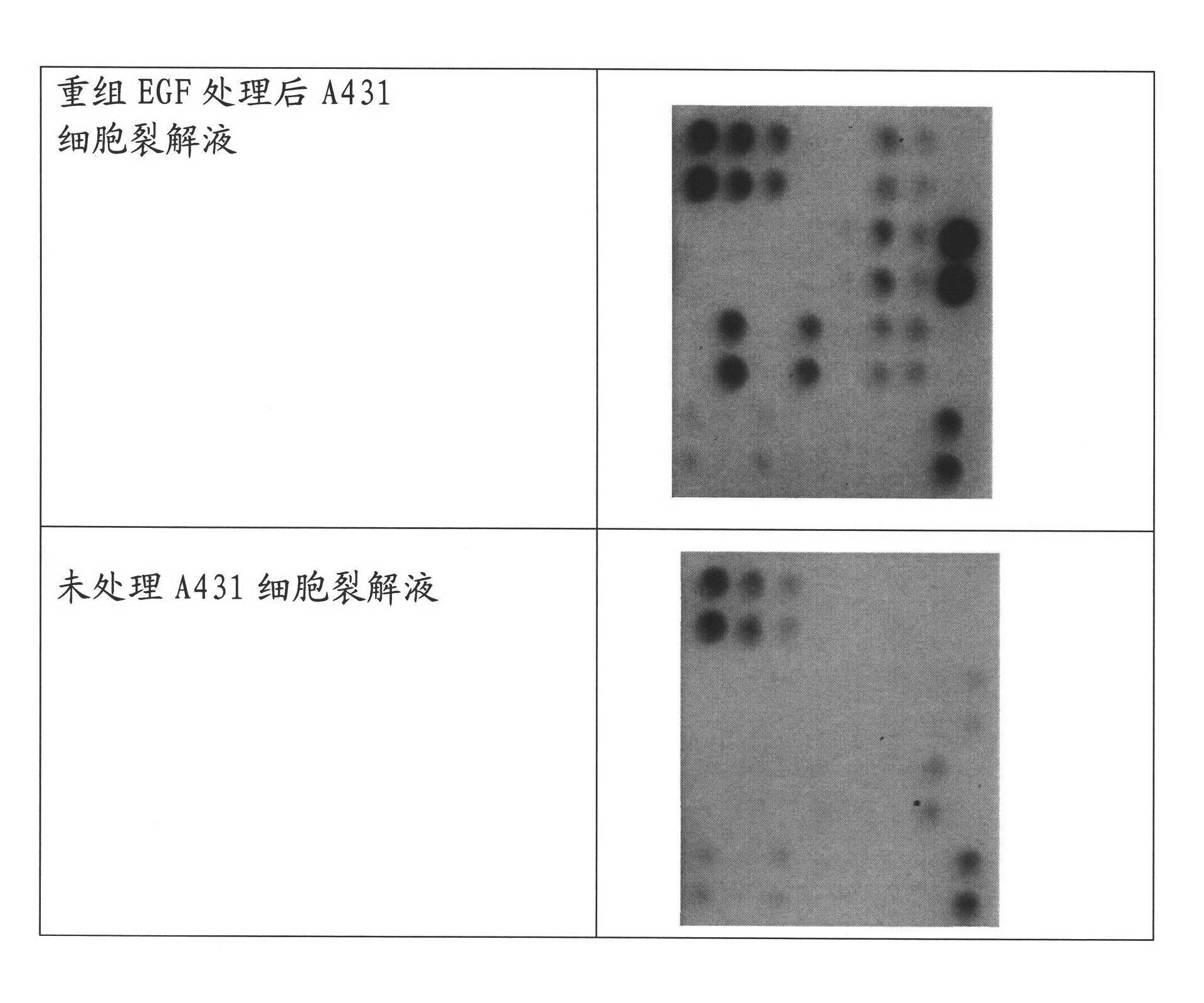 Kit for detecting phosphorylated epidermal growth factor receptor and preparation method thereof