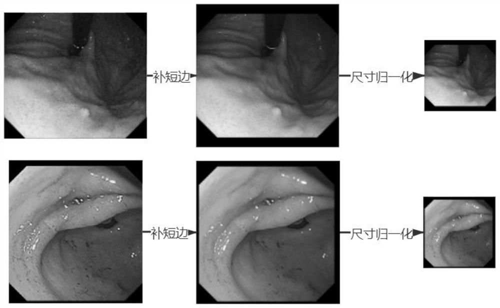 Automatic focus retaining method for upper gastrointestinal endoscopic image