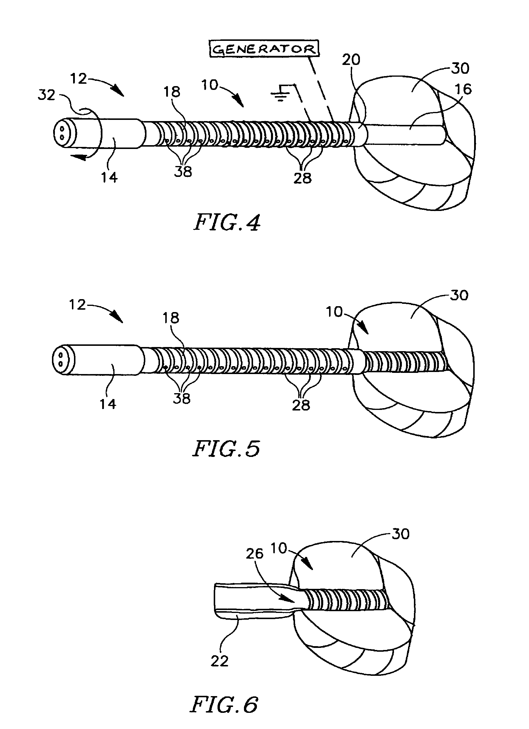 Implant and delivery tool therefor