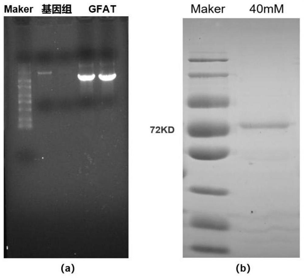 Preparation and application of glutamine-fructose-6-phosphate aminotransferase coding gene and glutamine-fructose-6-phosphate aminotransferase enzyme