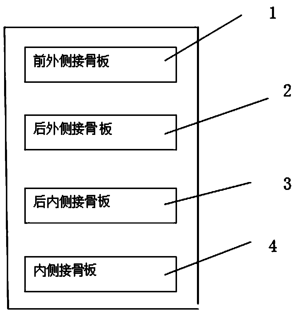 A proximal tibial bone plate system