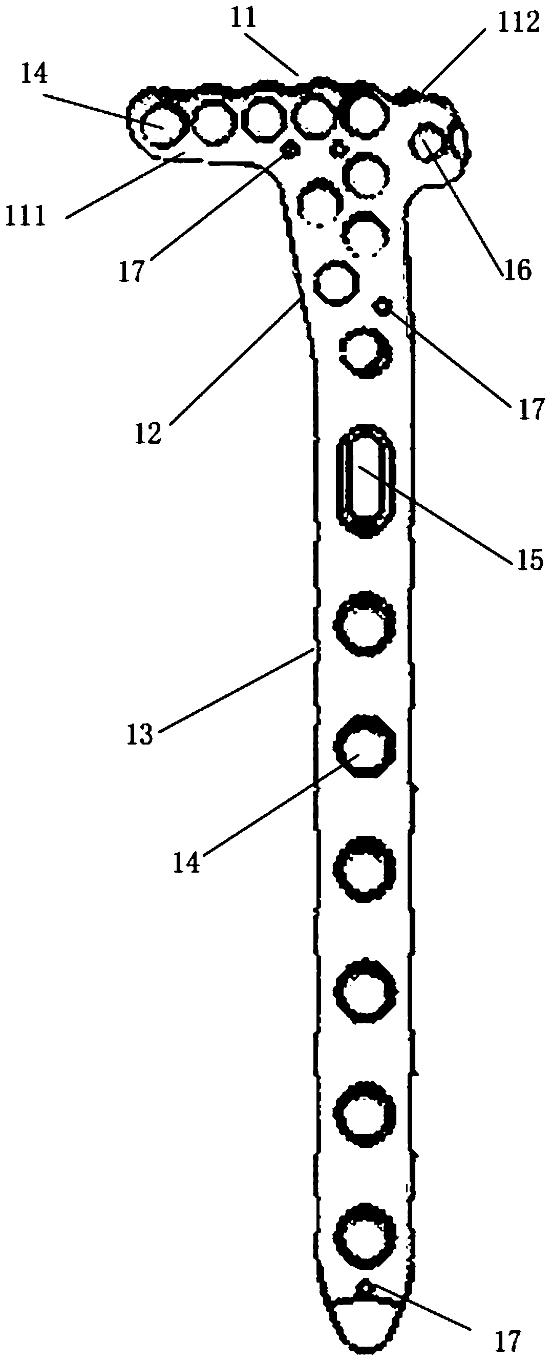 A proximal tibial bone plate system