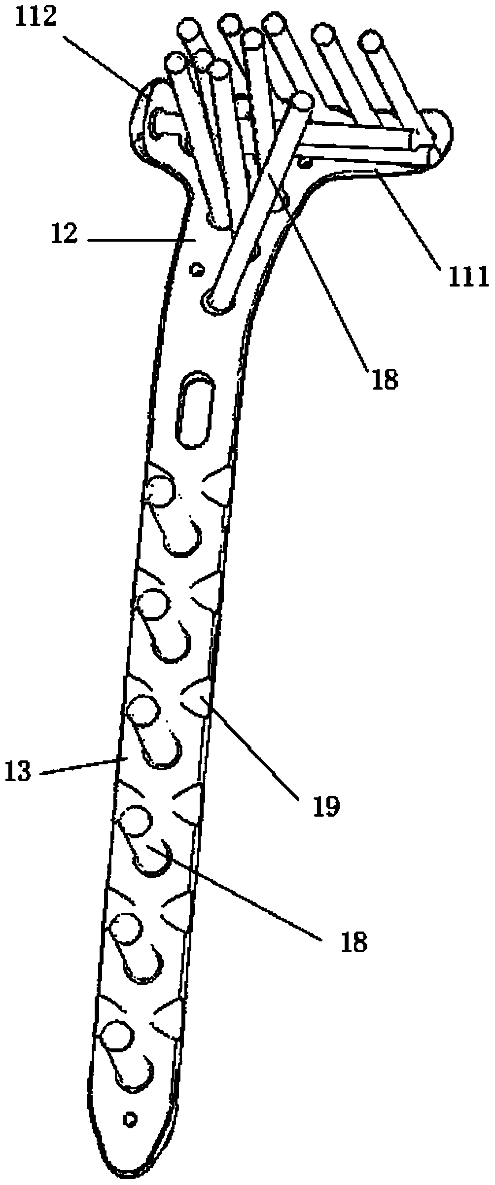 A proximal tibial bone plate system