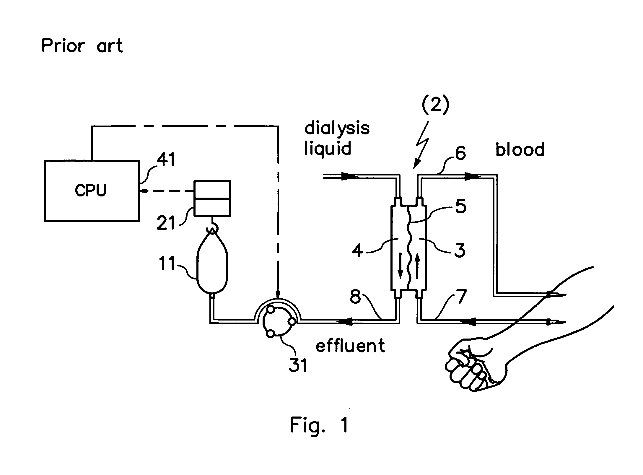 Extracorporeal treatment device with automatic emptying of waste bag