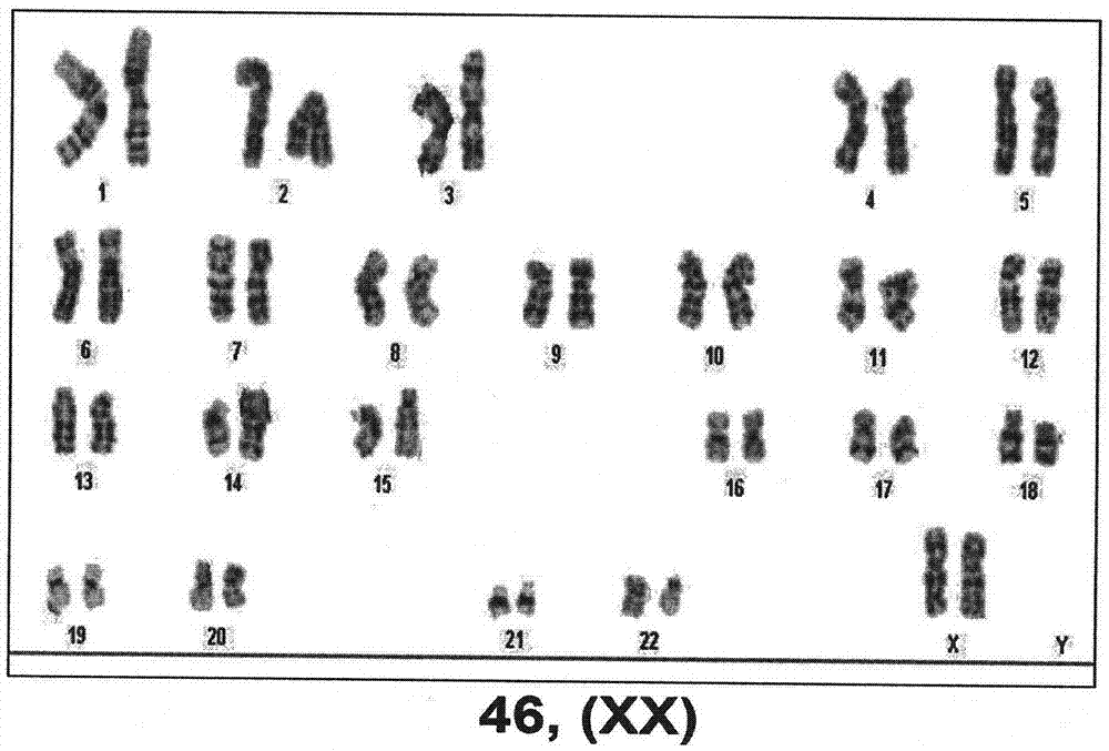 Technology for promoting direct trans-differentiation of umbilical cord blood CD34 positive cells into mesenchymal stem cells