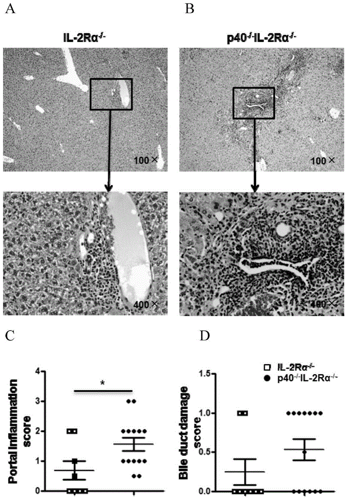 Method for breeding il-12p40(-/-)il-2rα(-/-) mice as animal models of liver fibrosis and primary biliary cirrhosis