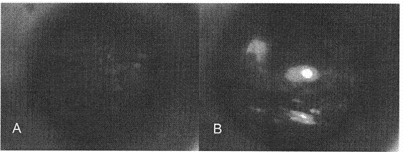 Method for mediated gene transfection