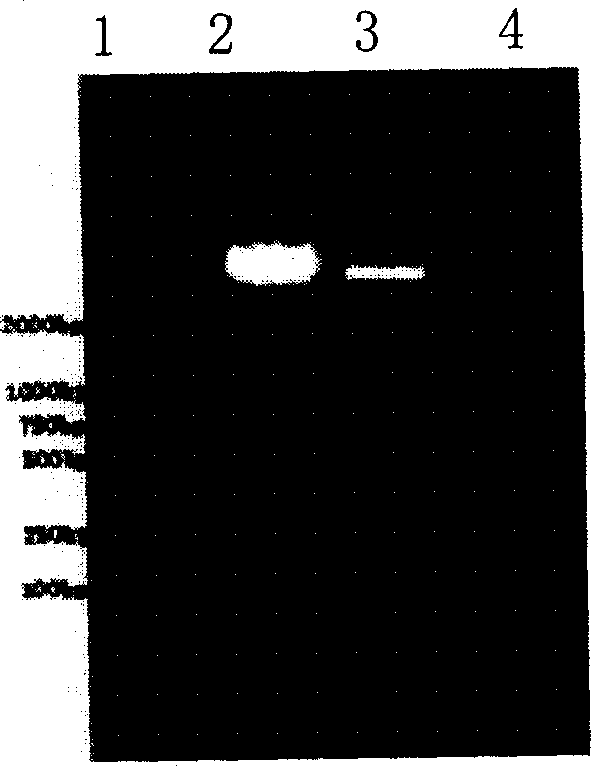 Glucose kinase derivant for inhibiting platelet aggregation and thrombase activity, and its preparing method