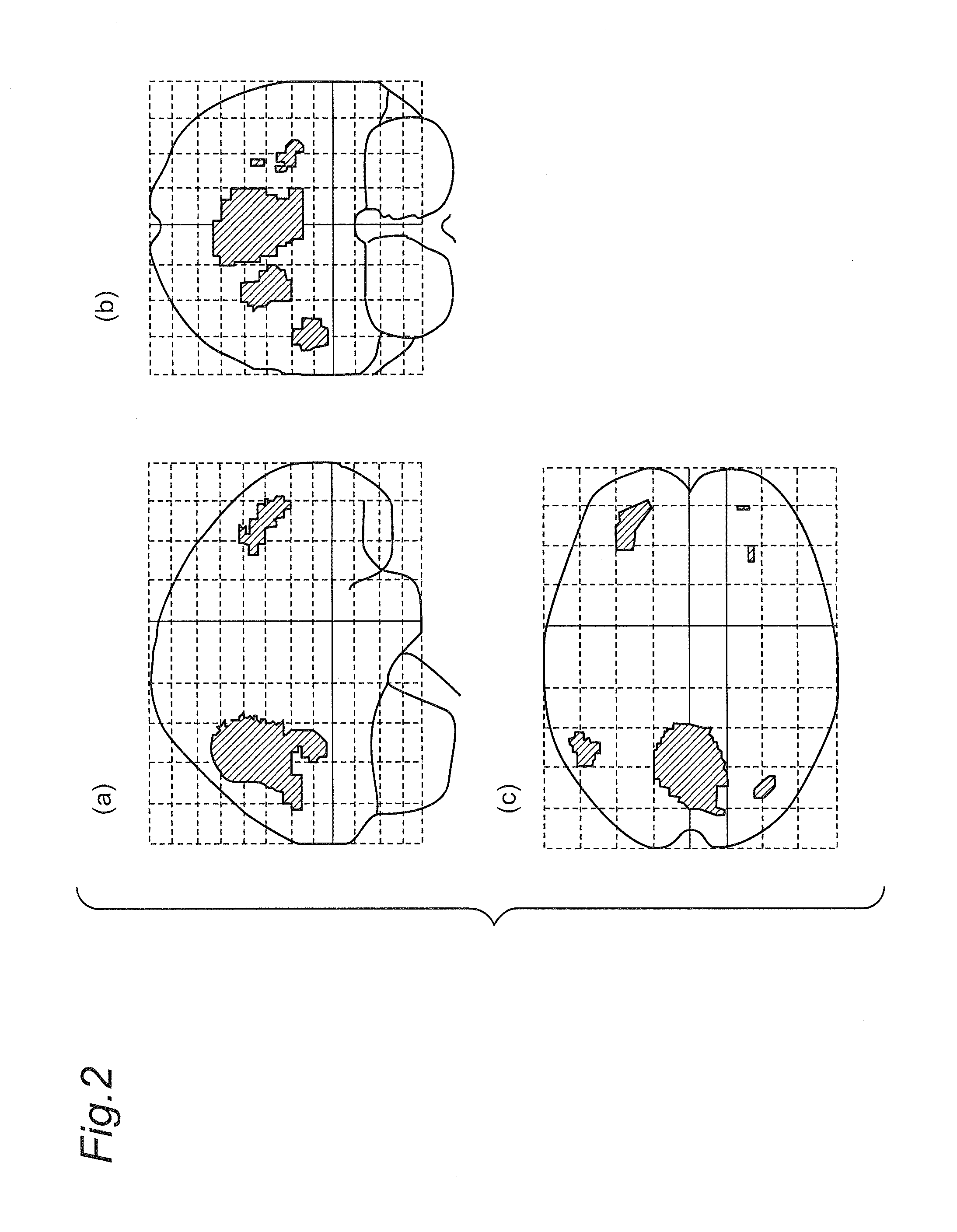 Vibration processing device and method
