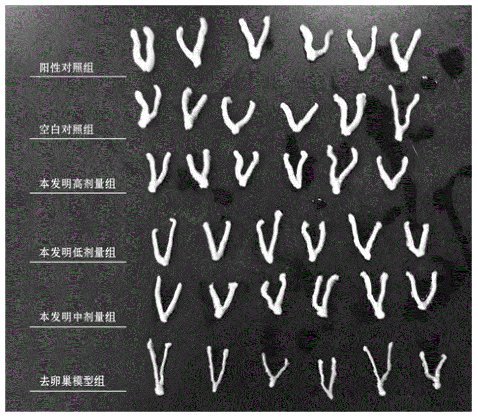 Health-care food capable of delaying female climacteric syndrome and preparation method thereof