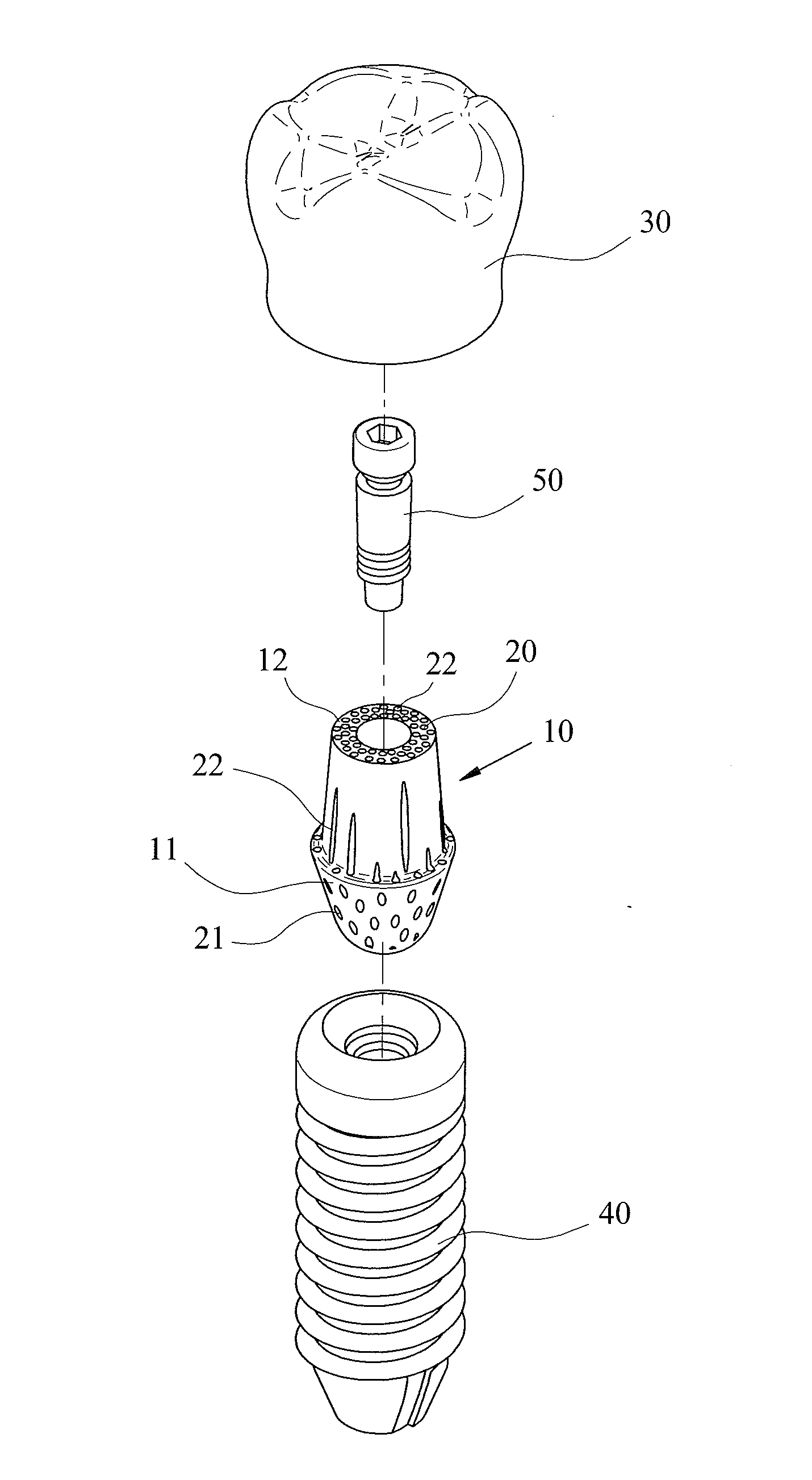 Fiber Abutment Material and Structure of Dental Implant