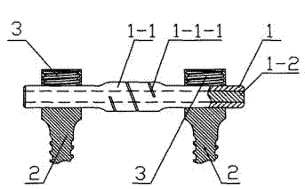 Dynamic lumbar vertebra fixing system