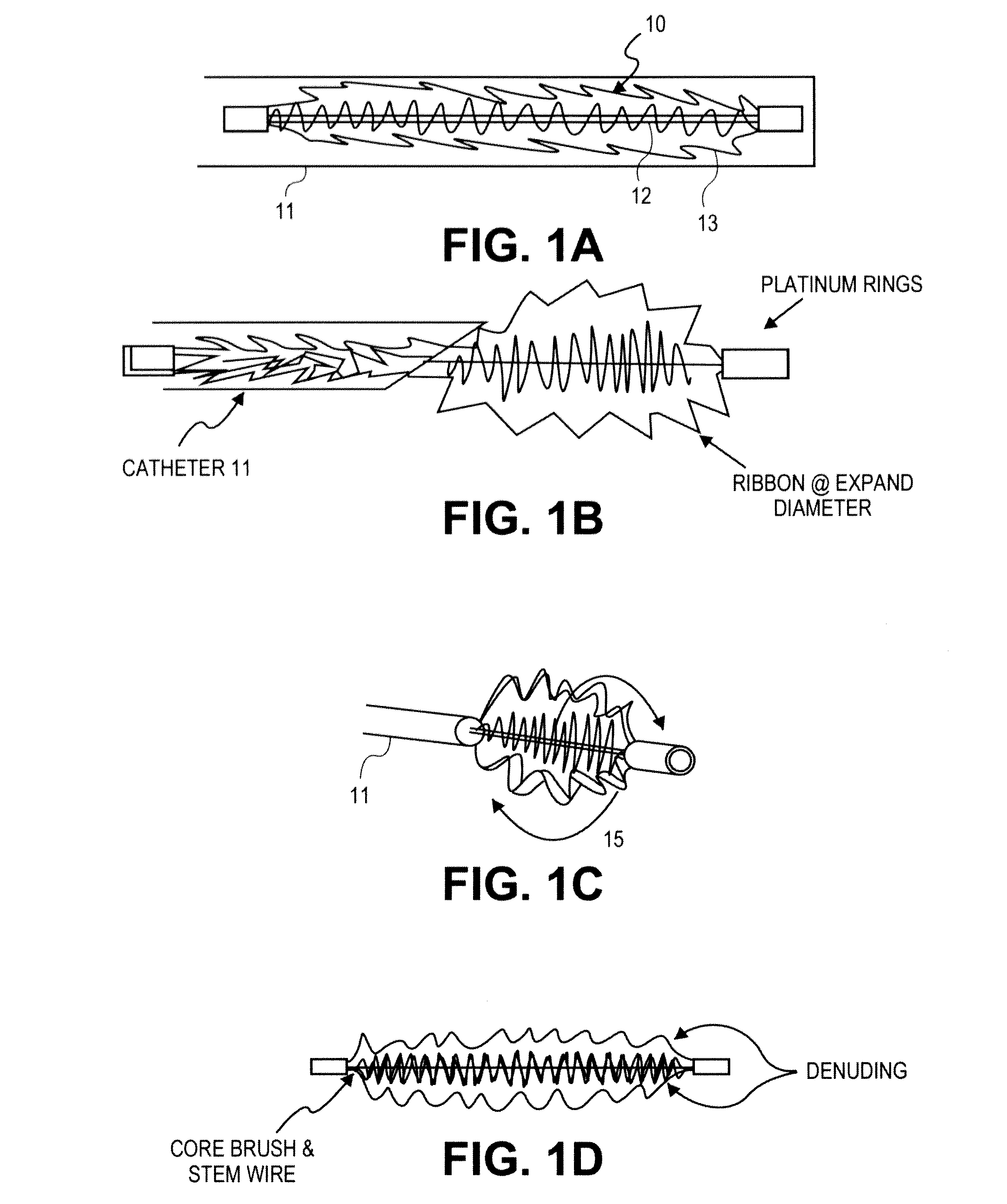 Methods and devices for deployment into a lumen