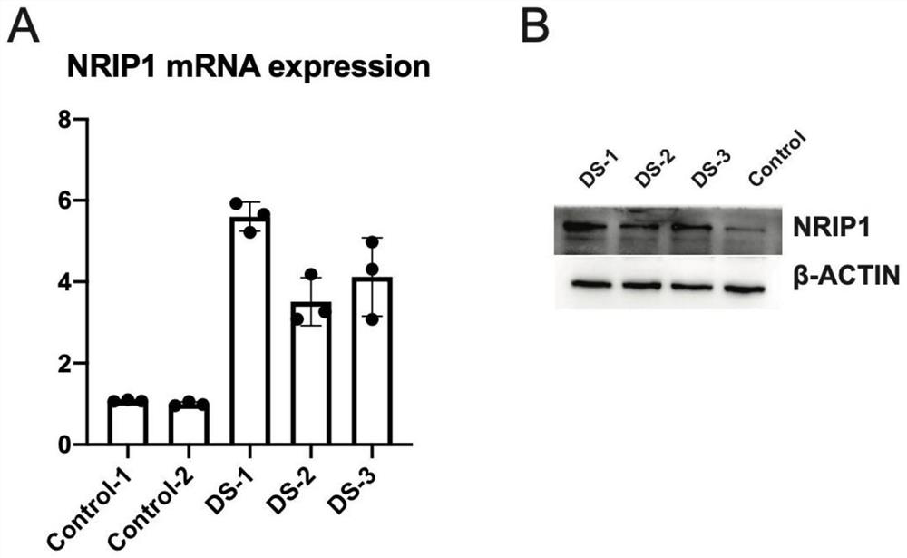 A method for assessing the risk of Down syndrome based on m6A methylation modification of nrip1 mRNA and its application