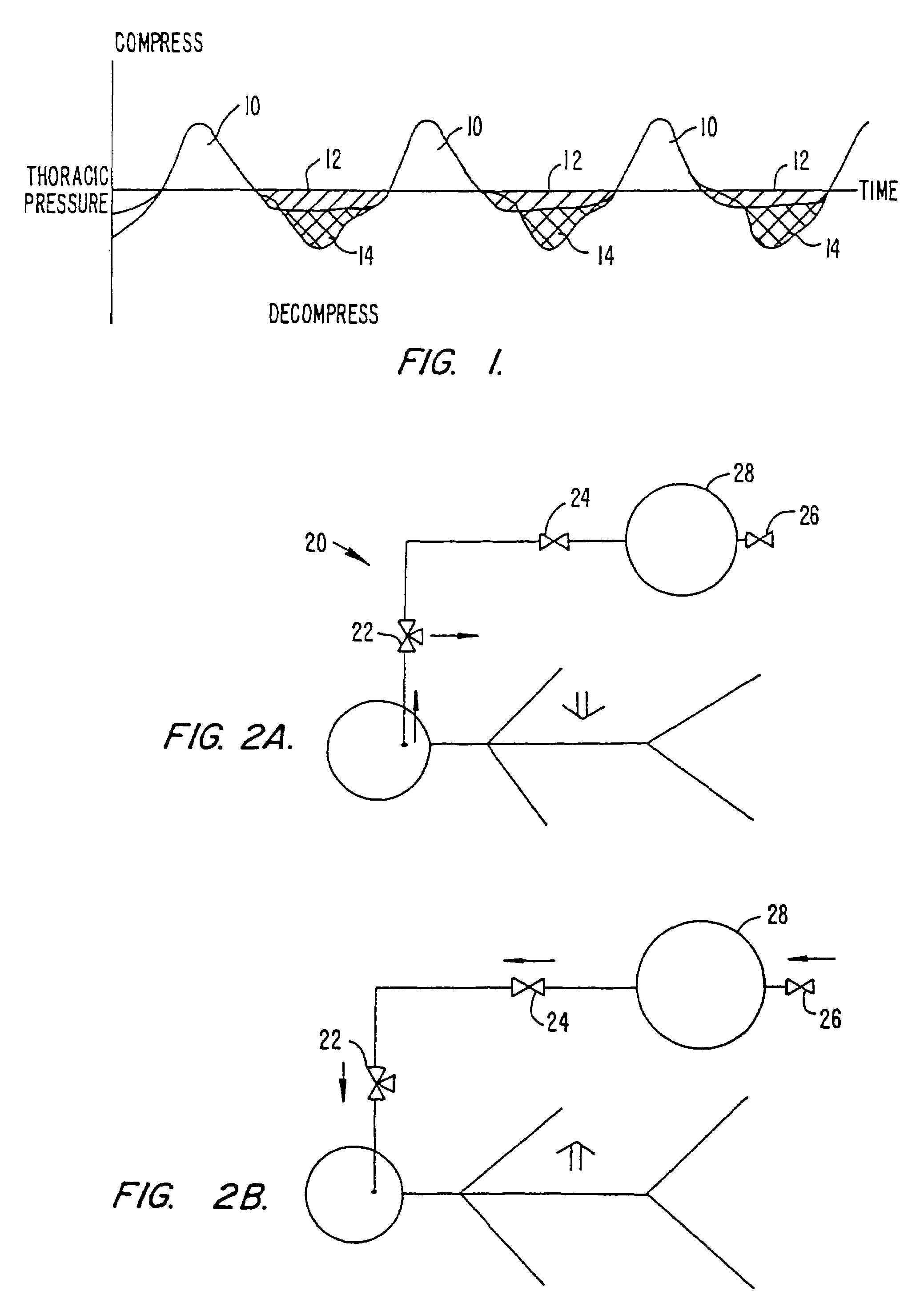 Diabetes treatment systems and methods