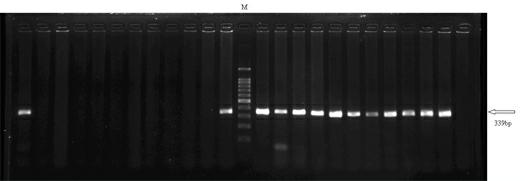 Molecular marker for Fenneropenaeus chinensis with high-pH resistance character and identification method using same
