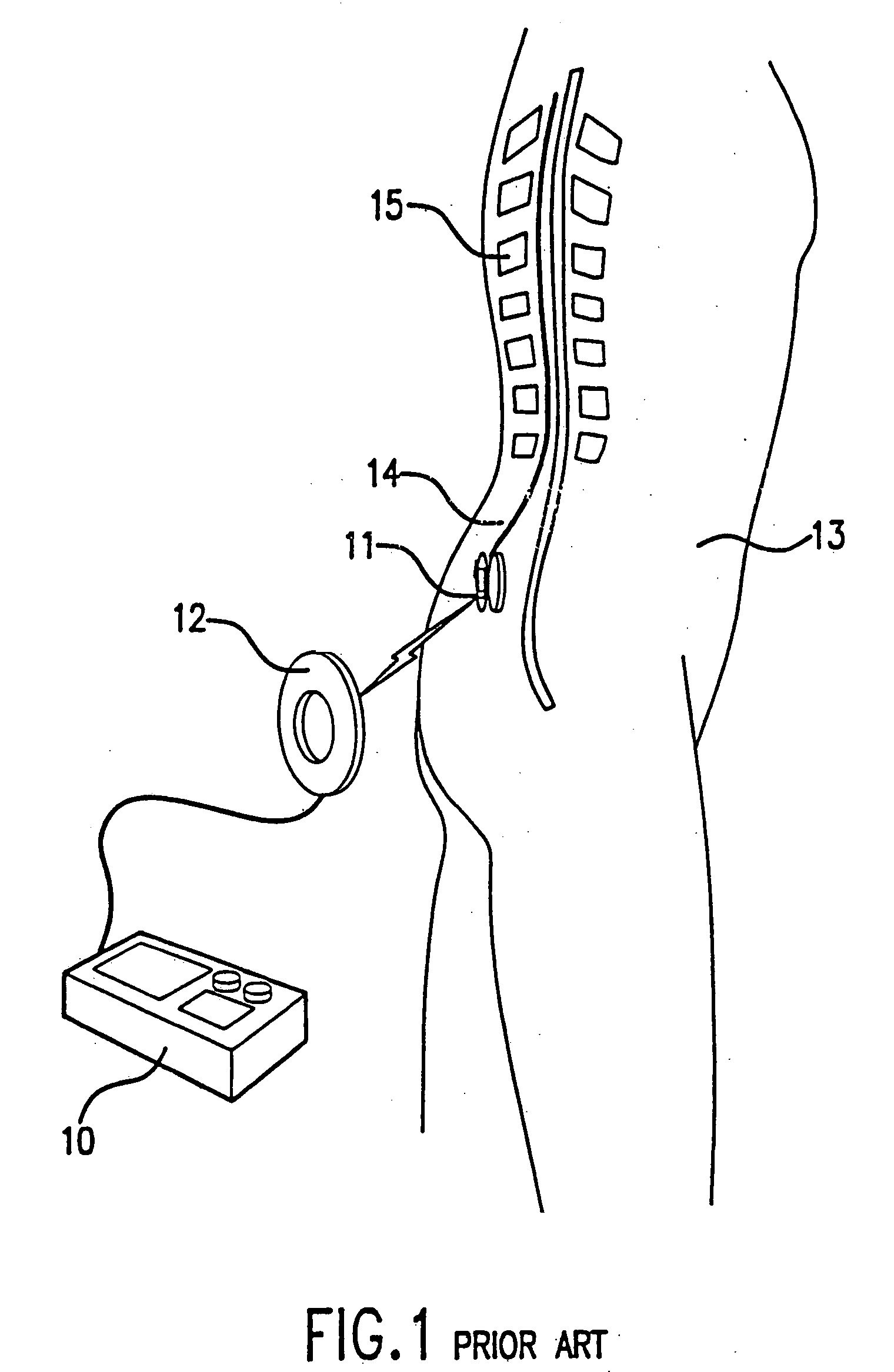 Patient interactive neurostimulation system and method