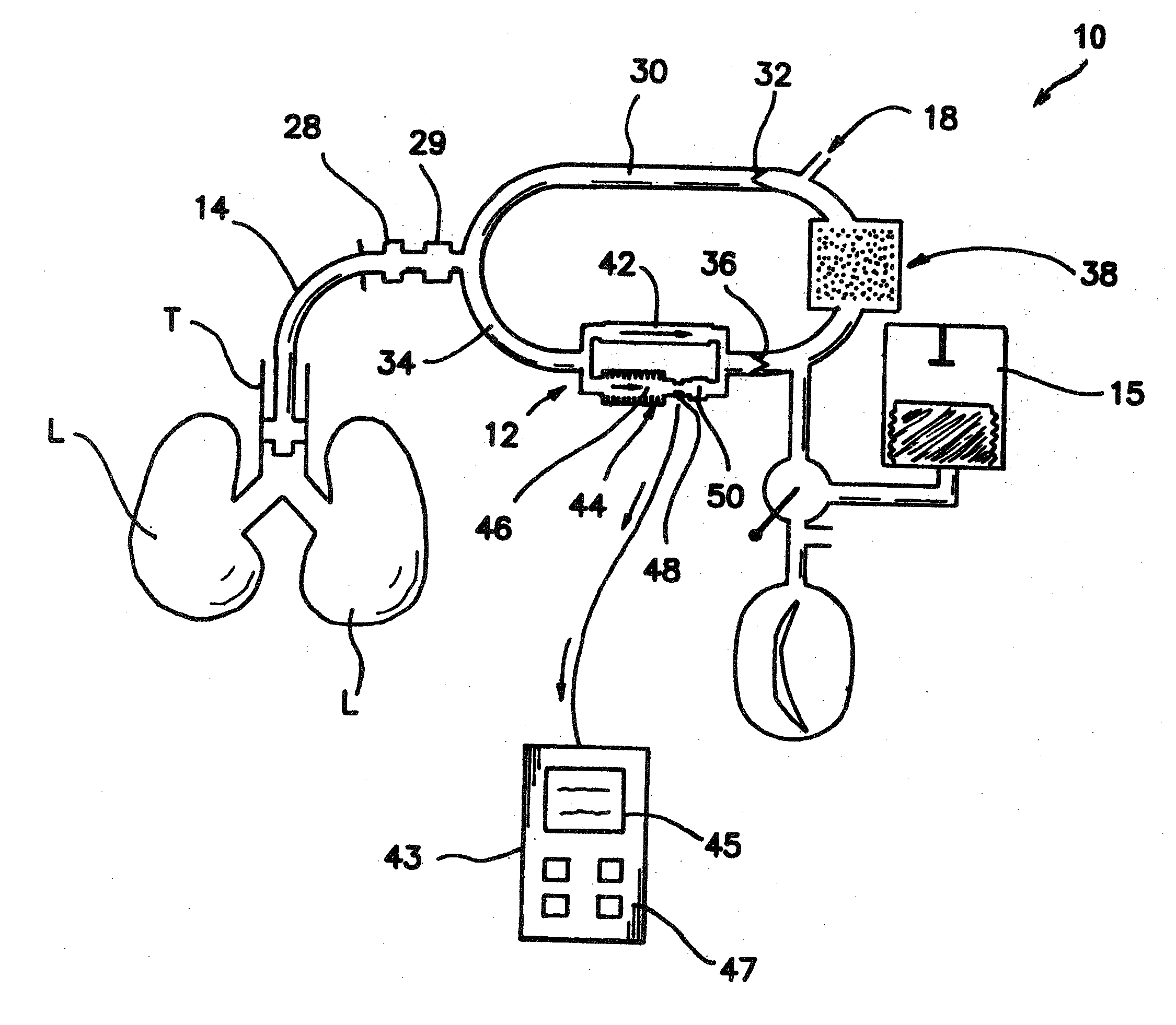 Bymixer Apparatus and Method for Fast-Response, Adjustable Measurement of Mixed Gas Fractions in Ventilation Circuits