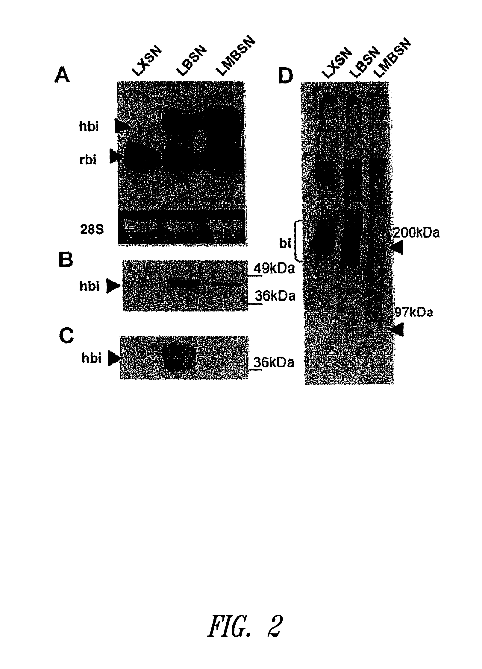 Compositions and methods for altering elastogenesis
