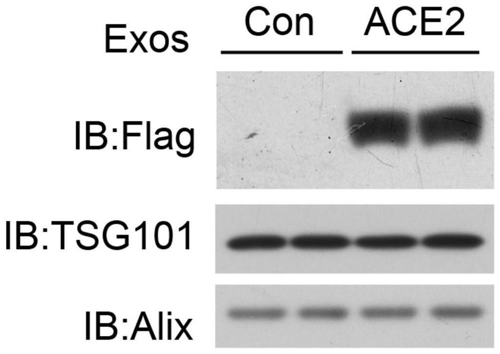 Preparation method and application of exosome for expressing ACE2 protein